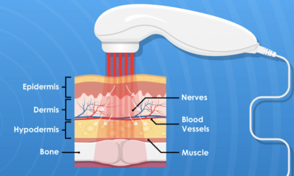 low level infrared light therapy