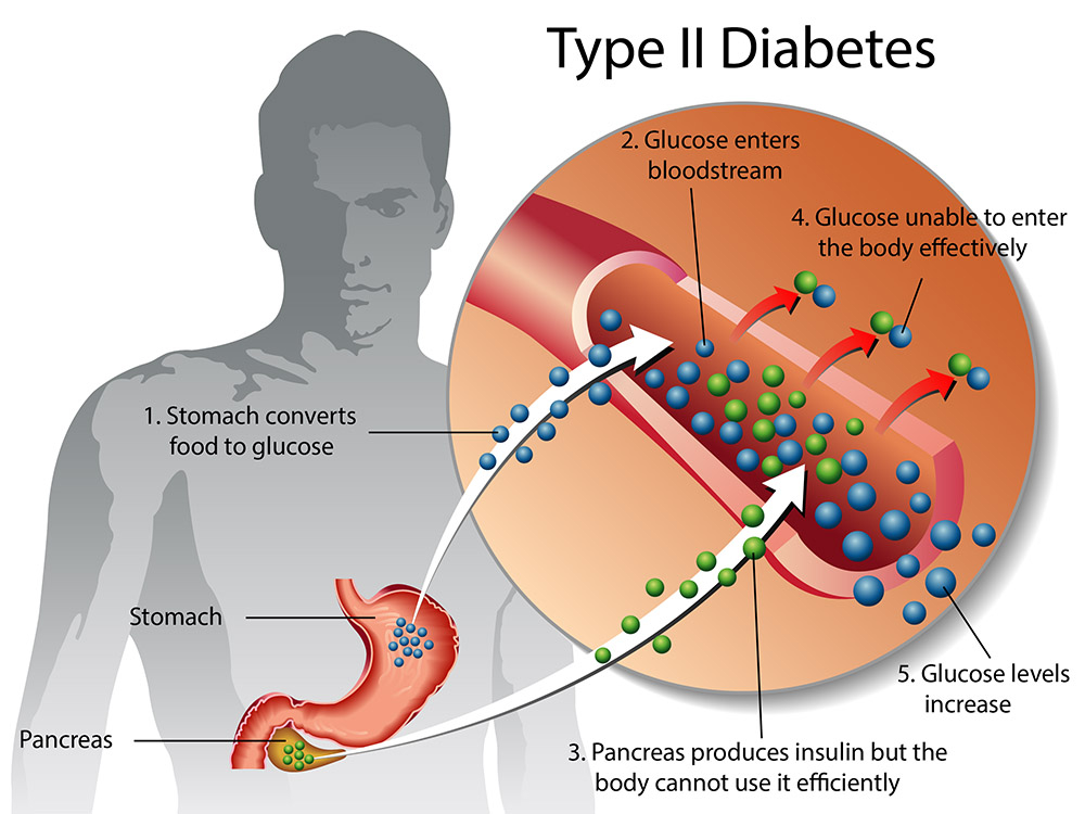 diabetes self management type2