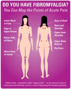 Fibromyalgia Point Map