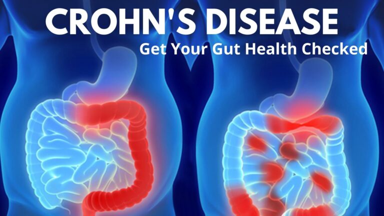 Gastroduodenal Crohn's Disease