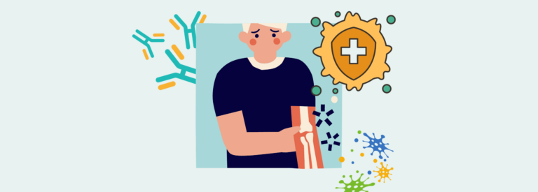 sjogrens flare