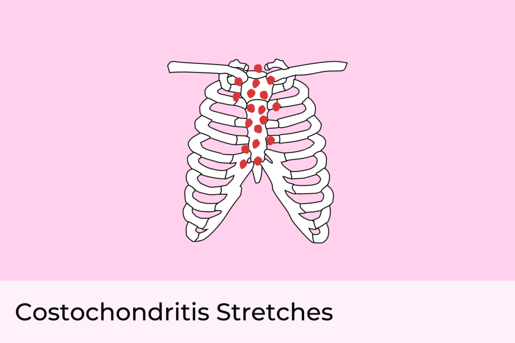 Costochondritis Stretches Exercises to Relieve Chest Pain