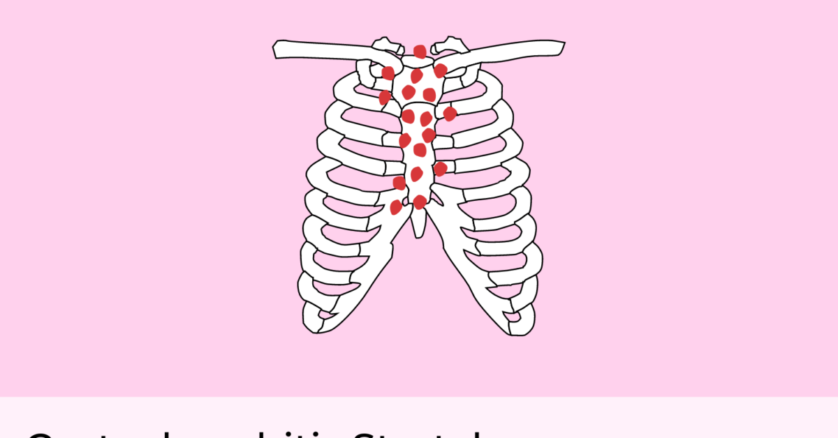 Costochondritis Stretches Exercises to Relieve Chest Pain