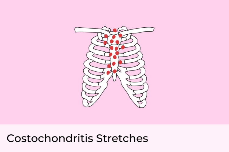 Costochondritis Stretches Exercises to Relieve Chest Pain