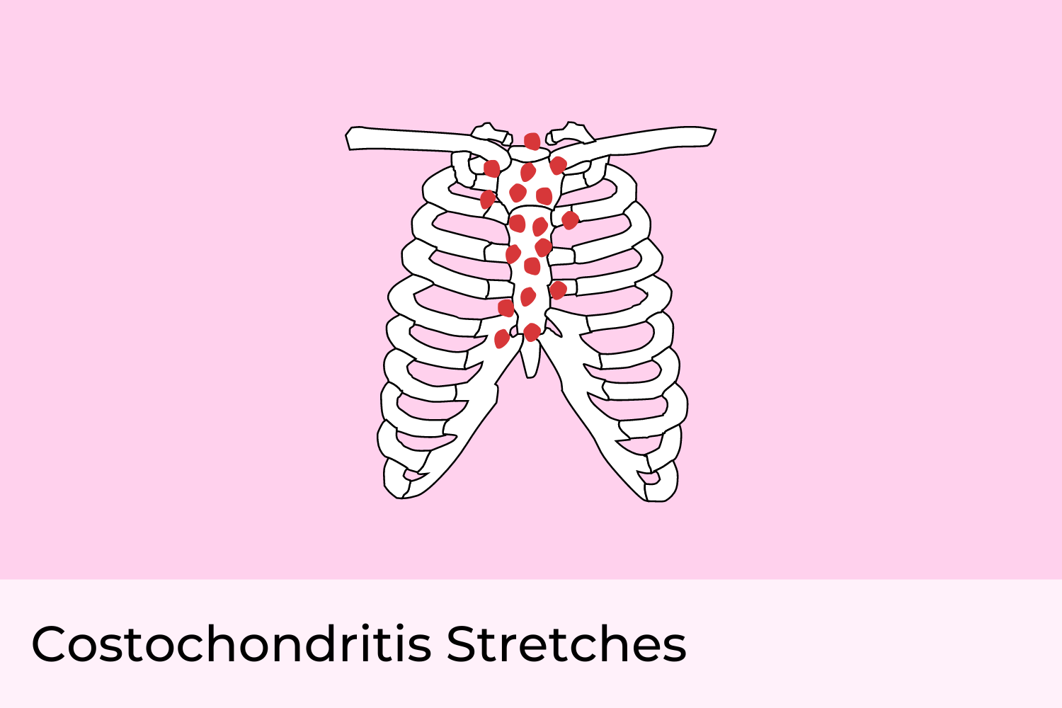 Costochondritis Stretches: Exercises to Relieve Chest Pain