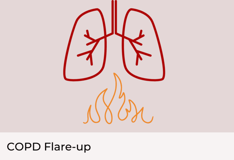 COPD Flare Up: A Painful Lung Condition