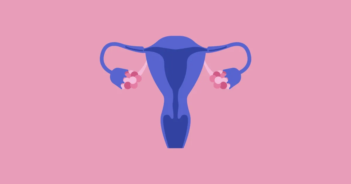 PCOS Hysterectomy: Understanding the Benefits and Risks