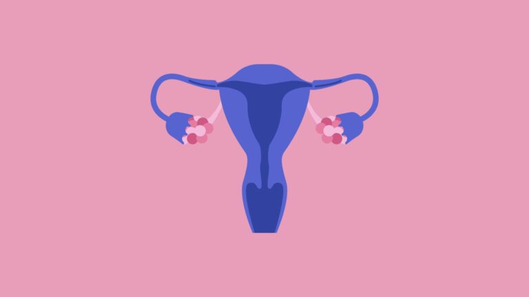 pcos-hysterectomy pcos hysterectomy