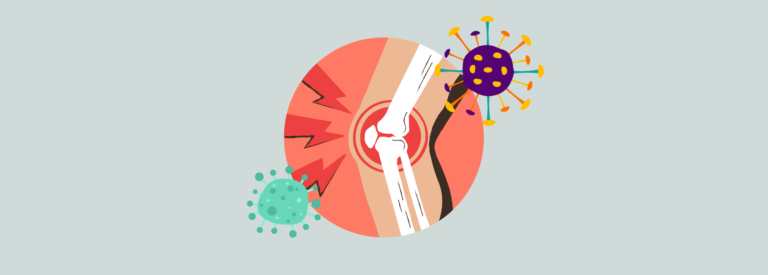 treating-knee-infections treating knee infections