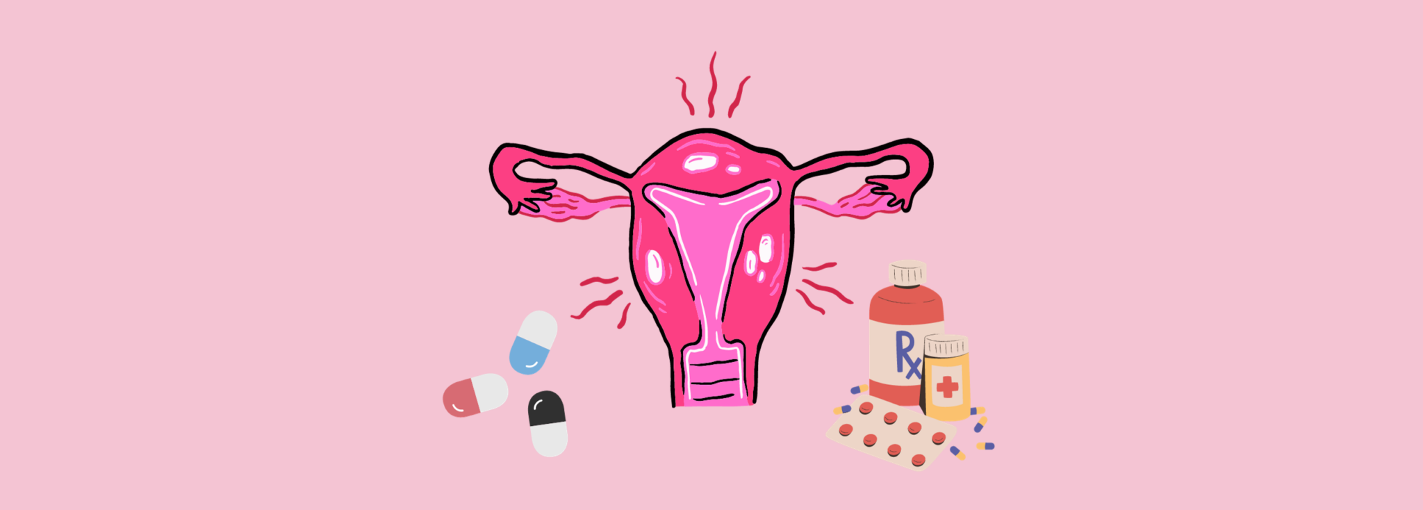 Metformin for PCOS: Benefits, Side Effects, and Dosage