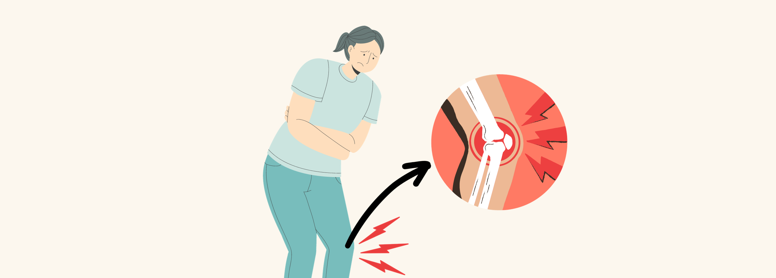 ulcerative colitis joint pain