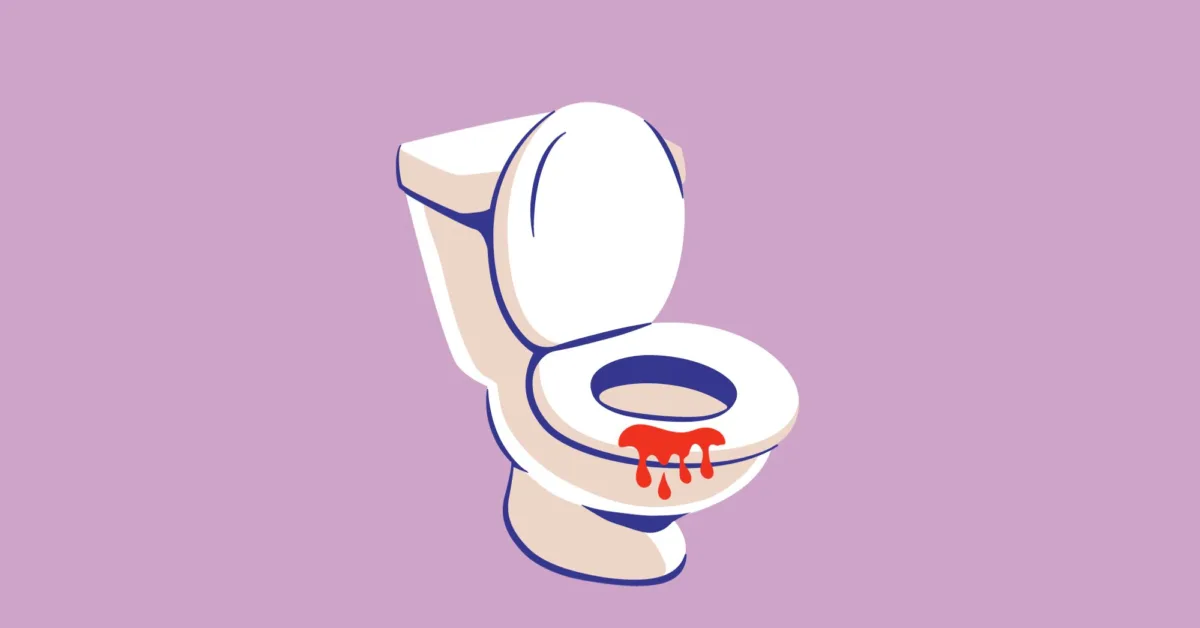 Understanding Diverticulitis and Blood in Stool