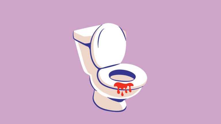 diverticulitis-blood-in-stool diverticulitis blood in stool