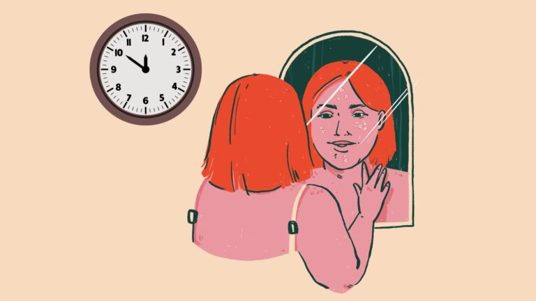 living with lupus
