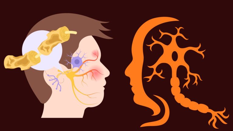 multiple sclerosis self care